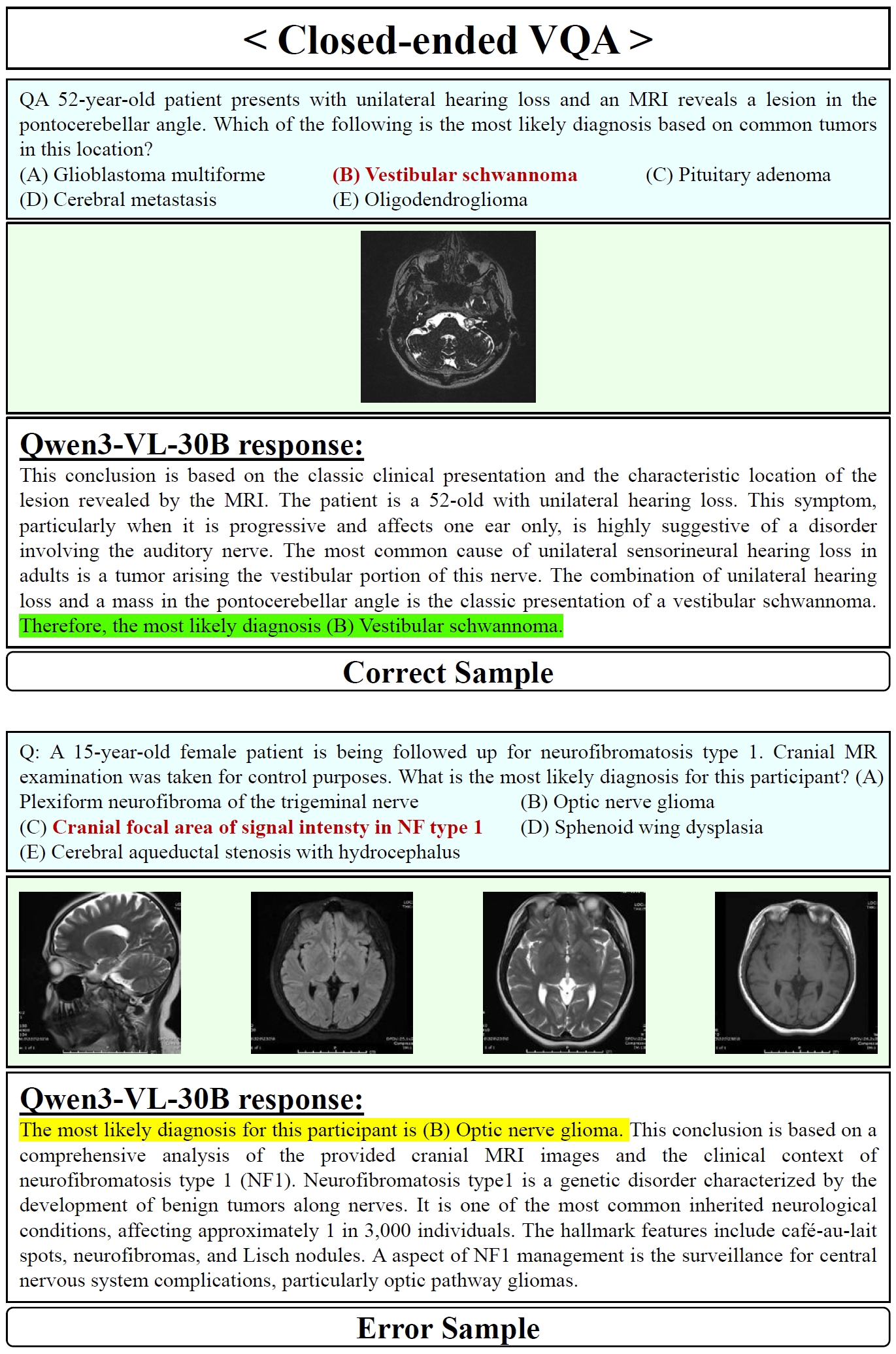 Qwen3-VL-30B Closed-ended VQA Samples